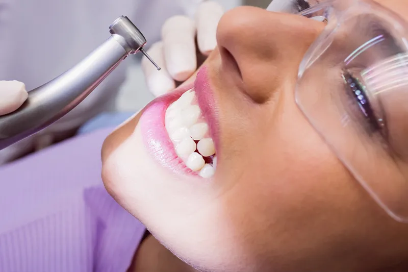 Бондинг Зъбна Пломба , Bonding Dental Filling