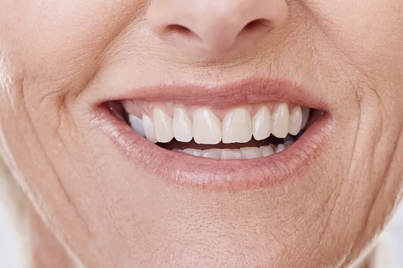 Лечение с Импланти, Implant Treatment