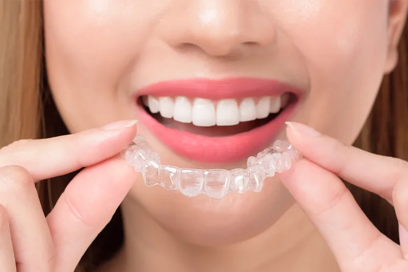 Прозрачни алайнери , Clear Aligners (Invisalign) - Kırklareli Dental Clinic Atlas Sea