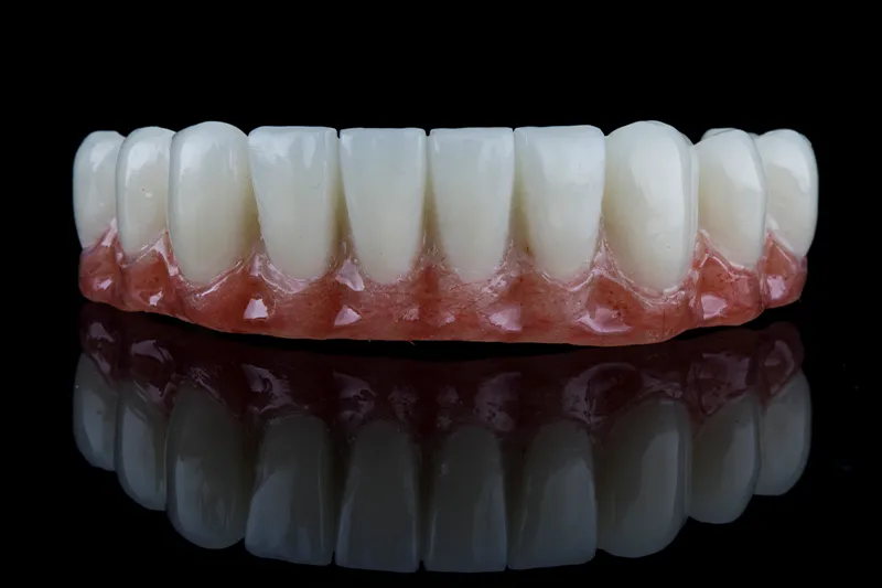 Фиксирани протези - Kırklareli Dental Clinic Atlas Sea